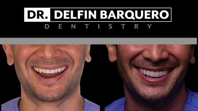 Slider image (8) DaVincis Dental Care Esthetic and Implant Dentistry